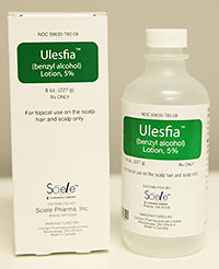 Ulesfia available for treatment of head lice