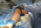 What Does Medically Clearing Your Patient With Rheumatic Disease For Surgery Entail? What Does Medically Clearing Your Patient With Rheumatic Disease For Surgery Entail?