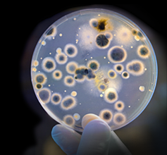 Drug-Resistant Bacteria Spreading Through Hospitals Drug-Resistant Bacteria Spreading Through Hospitals