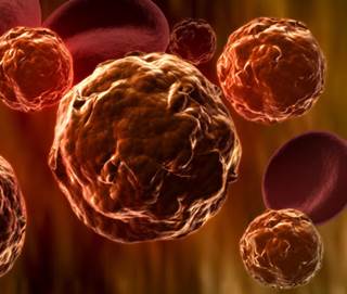 Low Risk of Treatment Failure When Using Penicillins vs Third-Generation Cephalosporins for CAP Low Risk of Treatment Failure When Using Penicillins vs Third-Generation Cephalosporins for CAP