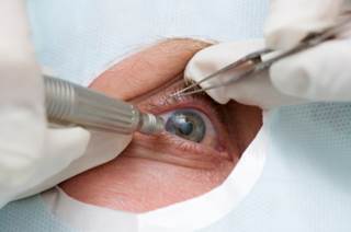 Botulinum Toxin May Be Quick, Safe Option for Senile Entropion Botulinum Toxin May Be Quick, Safe Option for Senile Entropion