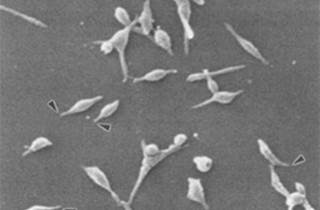 Macrolide-Resistant Bug ID'ed Across the U.S. Macrolide-Resistant Bug ID'ed Across the U.S.