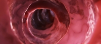 Dialysis Improves Kidney feature