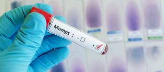 The investigation found that complications still occur even in patients who have received recommended vaccination The investigation found that complications still occur even in patients who have received recommended vaccination