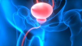 Strategies for diagnosis and management of urinary retention in MS Strategies for diagnosis and management of urinary retention in MS