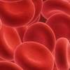 Pre-Op Anemia Tied to Adverse Outcomes in Elective Spine Sx Pre-Op Anemia Tied to Adverse Outcomes in Elective Spine Sx