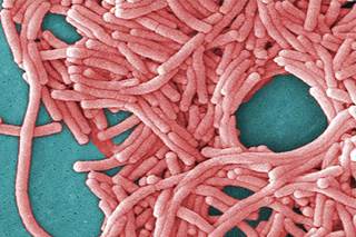 Legionnaire's Outbreak Linked to 31 Cases, 2 Deaths in NYC Legionnaire's Outbreak Linked to 31 Cases, 2 Deaths in NYC