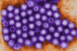 CDC: More than 600 Sick from Norovirus on Cruise Ship CDC: More than 600 Sick from Norovirus on Cruise Ship