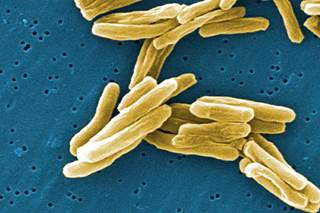 Report Highlights Danger of Drug-Resistant Tuberculosis Report Highlights Danger of Drug-Resistant Tuberculosis