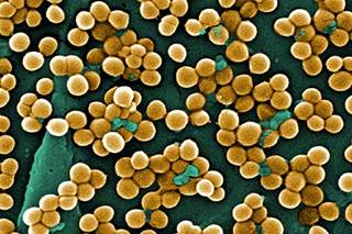 Unlikely Antibiotic Trio Eradicates MRSA in Study Unlikely Antibiotic Trio Eradicates MRSA in Study
