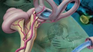 Severe Dizziness, Nausea, and Vomiting Prompt an ED Visit Severe Dizziness, Nausea, and Vomiting Prompt an ED Visit