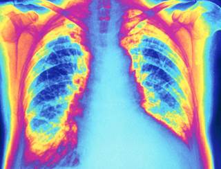 CDC: Over 200,000 CVD-Related Deaths Could Have Been Prevented CDC: Over 200,000 CVD-Related Deaths Could Have Been Prevented