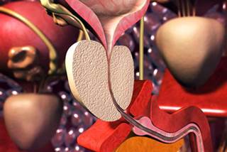 Rsearchers found that the adjusted mean sexual domain score decreased more for radical prostatectomy than for EBRT at 3 years. Rsearchers found that the adjusted mean sexual domain score decreased more for radical prostatectomy than for EBRT at 3 years.