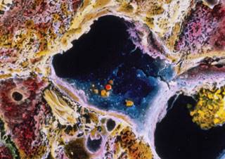 Dialysis providers and facilities should assess and improve infection control practices Dialysis providers and facilities should assess and improve infection control practices