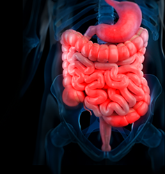 Review shows higher quality of life after elective laparoscopic resection versus conservative treatment Review shows higher quality of life after elective laparoscopic resection versus conservative treatment