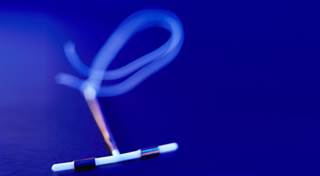 Are Postpartum Women Prone to IUD Uterine Perforation? Are Postpartum Women Prone to IUD Uterine Perforation?