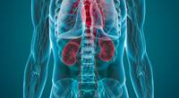 Older Individuals Have Atypical Stone Presentation Older Individuals Have Atypical Stone Presentation