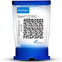 Xpert CT/NG Test for Chlamydia and Gonorrhea Approved Xpert CT/NG Test for Chlamydia and Gonorrhea Approved