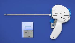 FDA Approves UroLift System for Enlarged Prostate FDA Approves UroLift System for Enlarged Prostate