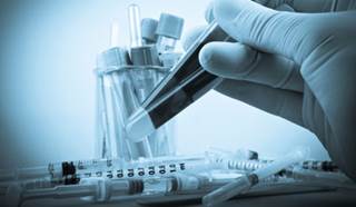 The study sheds further light on how HIV can persists in the body The study sheds further light on how HIV can persists in the body