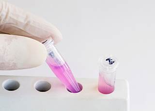 The Promise of Molecular Breast Tumor Subtyping The Promise of Molecular Breast Tumor Subtyping