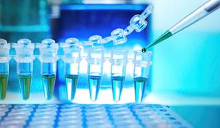 Newer Genetic Testing Technologies May Help Autism Dx in Children Newer Genetic Testing Technologies May Help Autism Dx in Children