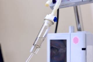 Who Benefits More From Uric Acid Therapy Post-Stroke? Who Benefits More From Uric Acid Therapy Post-Stroke?