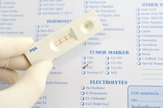 Article Offers Guidance on Discussing PSA With Patients Article Offers Guidance on Discussing PSA With Patients