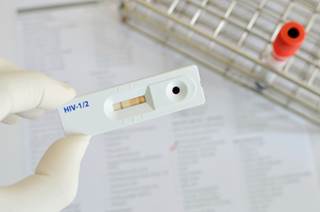 Ag/Ab combo testing can detect 82% of acute HIV infections detectable by pooled RNA testing Ag/Ab combo testing can detect 82% of acute HIV infections detectable by pooled RNA testing