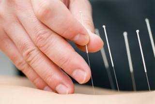 The Most Common Dermatological Adverse Events After Acupuncture The Most Common Dermatological Adverse Events After Acupuncture