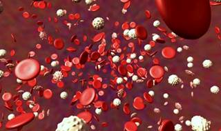 New Algorithm to Guide Antiplatelet Tx Post-PCI New Algorithm to Guide Antiplatelet Tx Post-PCI
