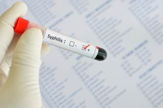 Syphilis Rates Increasing Among MSM Syphilis Rates Increasing Among MSM