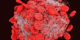 Many High-Risk Patients Still Not Receiving VTE Prophylaxis Many High-Risk Patients Still Not Receiving VTE Prophylaxis