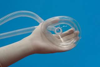Nitrous Oxide Shows Rapid Antidepressant Effects in Proof-of-Concept Trial Nitrous Oxide Shows Rapid Antidepressant Effects in Proof-of-Concept Trial