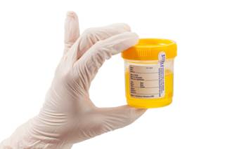 7 Recommendations for Hematuria Evaluation 7 Recommendations for Hematuria Evaluation