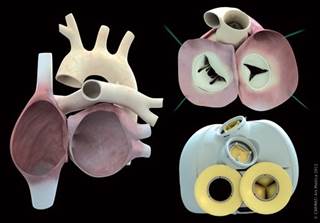 New Artificial Heart Mixes Synthetic and Natural Materials New Artificial Heart Mixes Synthetic and Natural Materials