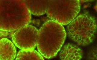 Mini-Stomachs Grown from Stem Cells to Study Cancer, Ulcers Mini-Stomachs Grown from Stem Cells to Study Cancer, Ulcers