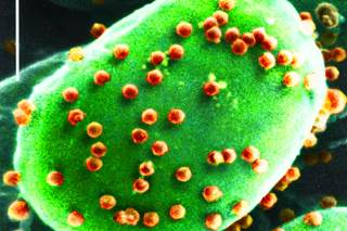 What Is the "Stupidity Virus"? What Is the "Stupidity Virus"?