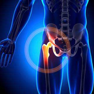 WOMAC OA Index scores for pain or function did not differ for patients with psoriasis, osteoarthritis WOMAC OA Index scores for pain or function did not differ for patients with psoriasis, osteoarthritis