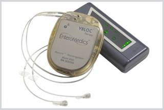 First Weight Loss Device Approved Since 2007 First Weight Loss Device Approved Since 2007