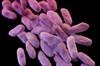 Drug Approved for Complicated Urinary Tract Infections Drug Approved for Complicated Urinary Tract Infections