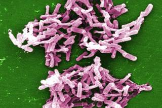 Review: Diagnosis, Treatment of C. difficile in Adults Review: Diagnosis, Treatment of C. difficile in Adults