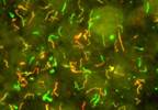 Results From the Persistent Lyme Empiric Antibiotic Study Results From the Persistent Lyme Empiric Antibiotic Study
