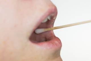 Testing Saliva Could Help Diagnose Autism Testing Saliva Could Help Diagnose Autism