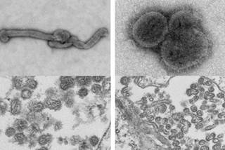 CDC: New Info on Novel "Bourbon Virus" CDC: New Info on Novel "Bourbon Virus"