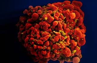 Clinical manifestations of acute HIV-1 infection common just before and at time of peak viremia Clinical manifestations of acute HIV-1 infection common just before and at time of peak viremia