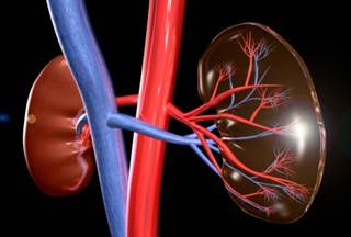 Long-Term Use of Obesity Drug, Then Sudden Kidney Dysfunction Long-Term Use of Obesity Drug, Then Sudden Kidney Dysfunction