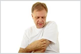 Arthritis Drug May Help Eczema Patients, Too Arthritis Drug May Help Eczema Patients, Too