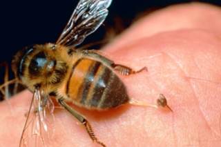 The Buzz on Bee-Venom Therapy The Buzz on Bee-Venom Therapy