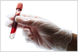 How Does OSAS Severity Affect Glucose Tolerance? How Does OSAS Severity Affect Glucose Tolerance?